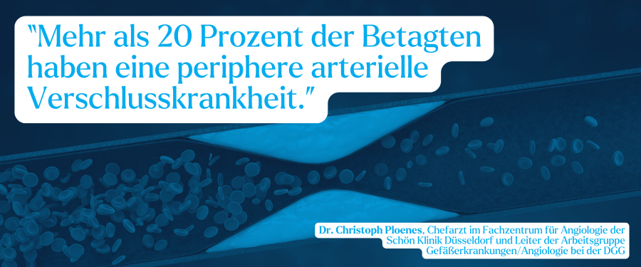 Mehr als 20 Prozent der Betagten haben eine periphere arterielle Verschlusskrankheit.